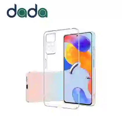 Ốp lưng Xiaomi Redmi Note 11/11S Dada trong suốt 1