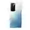 wp-content/uploads/images/products/259002/thay-vo-xiaomi-redmi-10-17622736765974.jpg