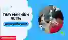 Thay màn hình Nubia quận Hoàn Kiếm giá rẻ